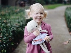 Upaya Ibu Agar Putrinya yang Punya Tanda Lahir Besar Tetap Pede