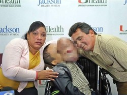 Berawal Sebesar Jerawat, Tumor Ini Tutupi Wajah Remaja dari Kuba