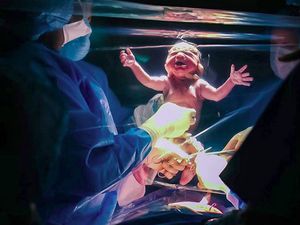 Oek, oek! Momen Saat si Kecil Lahir Lewat Operasi Caesar