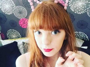 Foto: Kisah Jade, Barbie di Kehidupan Nyata yang Idap Penyakit Langka