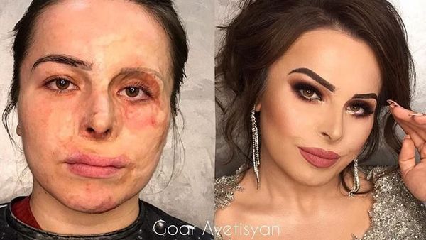 Foto: Transformasi Makeup Dramatis Penderita Kanker Hingga Korban Luka Bakar