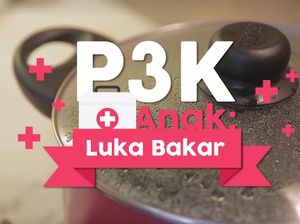 Pertolongan Pertama Saat Anak Alami Luka Bakar