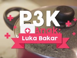 Pertolongan Pertama Saat Anak Alami Luka Bakar
