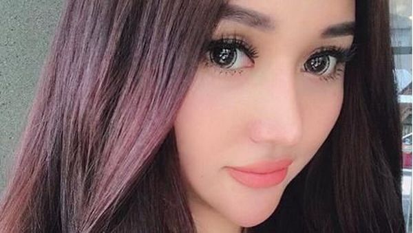 Beda Jauh, Intip 7 Transformasi Lucinta Luna Dulu Vs Usai Oplas Ganti Kepala