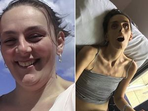 Kampanyekan Bahaya Kanker Serviks, Pria Ini Unggah Foto Kesakitan Istrinya