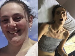 Kampanyekan Bahaya Kanker Serviks, Pria Ini Unggah Foto Kesakitan Istrinya