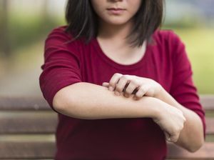 Fakta-fakta Alergi pada Anak yang Bunda Perlu Tahu