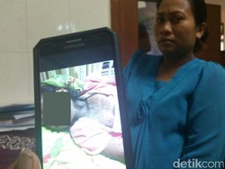 Kulit Anak 9 Tahun Melepuh Setelah Minum Obat Turun Panas