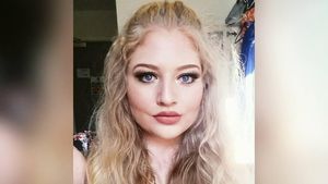 Foto Pengidap Body Dysmorphic Disorder yang Selalu Merasa Jelek
