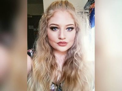 Foto Pengidap Body Dysmorphic Disorder yang Selalu Merasa Jelek