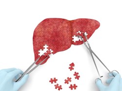 Beragam Mitos Masih Dipercaya, Pengendalian Hepatitis Terhambat