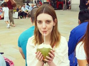 Disangka Pura-pura Cacat, Pengidap Sindrom Langka Ini Ditolak Petugas