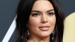 Nggak Ada Manusia Sempurna, Buktinya 10 Artis Ini Pernah Berjerawat Parah