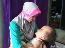 Kisah Nabil, Bayi dari Keluarga Miskin Penderita Hydrosefalus