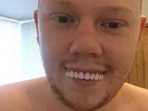 Pesan Veneer Gigi Online, Pria Ini Malah Jadi Bahan Tertawaan