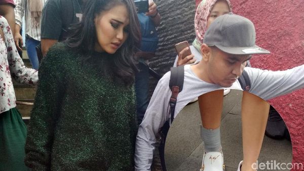 Ayu Ting Ting Pincang Karena Main Bola, Kok Bisa?