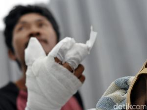 Main Petasan Saat Nikahan Tetangga, Barna Kehilangan Dua Jarinya