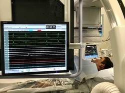 Jantung Bocah dari Timor Leste Ini Berdetak Hingga 200 Kali Per Menit