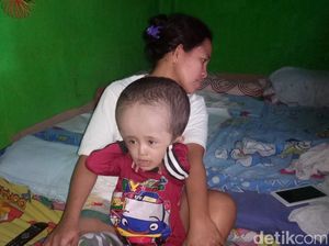 Kisah Rahman, Bocah Penderita Hidrosefalus asal Rancaekek Bandung Kisah Rahman, Bocah Penderita Hidrosefalus asal Rancaekek Bandung