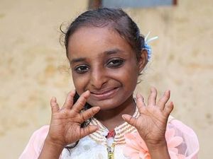 Dijuluki Gadis Tikus, Tinggi Gadis 18 Tahun Ini Cuma 84 Cm Dijuluki Gadis Tikus, Tinggi Gadis 18 Tahun Ini Cuma 84 Cm