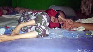 Derita Rahman, Bocah Penderita Hidrosefalus
