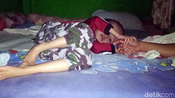 Derita Rahman, Bocah Penderita Hidrosefalus