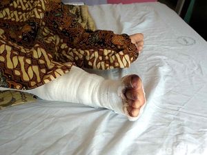 Bandar Narkoba Bakar Kekasihnya yang Masih Anak-anak