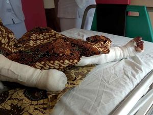 Pilu Rafi, Bocah Kena Luka Bakar karena Kesetrum Saat Bermain