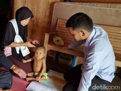 Akbar Penderita Atresia Bilier di Lhokseumawe Butuh Bantuan