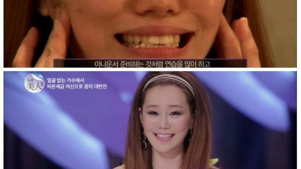 Foto: Transformasi Menakjubkan Wanita yang Tampil Menarik Setelah Oplas