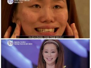 Foto: Transformasi Menakjubkan Wanita yang Tampil Menarik Setelah Oplas