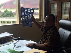 Dirujuk ke RSUP, Bocah yang Dianiaya Ibu Kandungnya Mulai Membaik