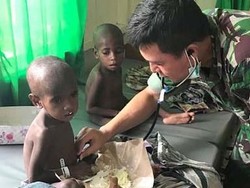 Marak Gizi Buruk di Pelosok Papua, Jokowi akan Relokasi Warga ke Kota