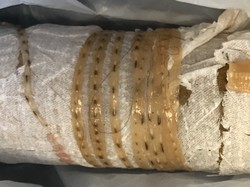 Cacing Pita 1,7 Meter Keluar dari Tubuh Pria Penggemar Sushi