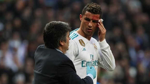 Cristiano Ronaldo mengalami cedera robek di pelipis kiri saat membela Madrid menghadapi Deprtivo La Coruna. (