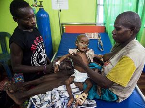 646 Anak Terkena Wabah Campak, Kemenkes Kirim 1,2 Ton Obat ke Asmat 646 Anak Terkena Wabah Campak, Kemenkes Kirim 1,2 Ton Obat ke Asmat