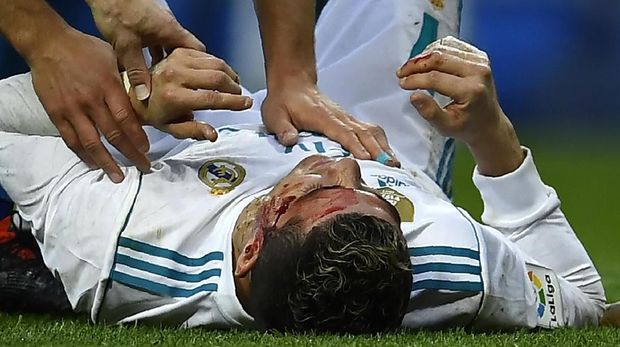 Cristiano Ronaldo dicemooh karena menggunakan telepon genggam setelah pelipisnya berdarah.