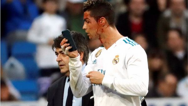 Meme Berdarah Ronaldo Ramai Jadi Gunjingan Netizen