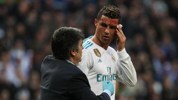 Foto: Ronaldo Berdarah-darah di Bernabeu
