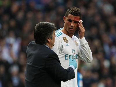 Foto: Ronaldo Berdarah-darah di Bernabeu