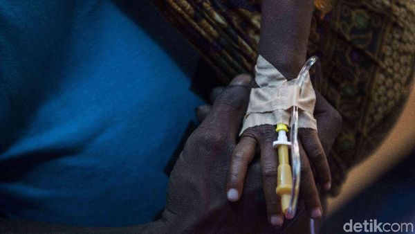 Pasien Membludak, Korban Gizi Buruk Dirawat di Garasi Mobil