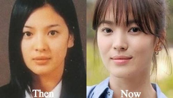 Tanpa Operasi Plastik, 9 Selebriti Top Korea Ini Terbukti Cantik Alami