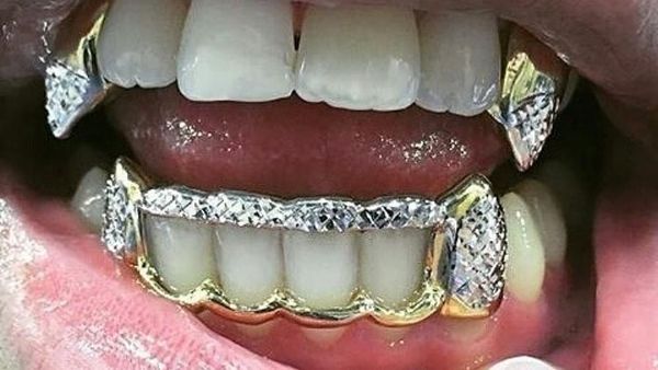 Foto Orang-orang dengan Gigi Emas Terunik, Mau Lihat?