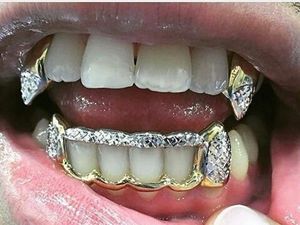 Foto Orang-orang dengan Gigi Emas Terunik, Mau Lihat?