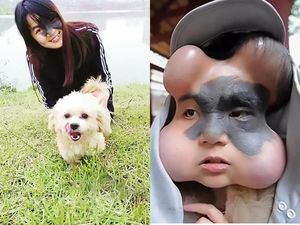 Khawatir Tanda Lahir Jadi Kanker, Wanita Ini Balonkan Wajahnya