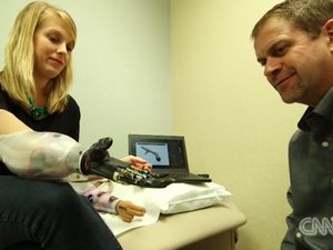 Putus Dikoyak Hiu, Lengan Wanita Ini Diganti dengan Lengan Pintar