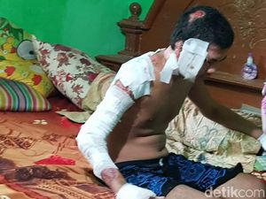 Korban Ledakan Pabrik Kembang Api Kosambi Asal Tegal Belum Disantuni Korban Ledakan Pabrik Kembang Api Kosambi Asal Tegal Belum Disantuni