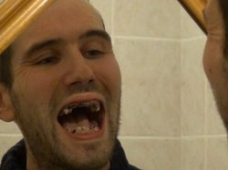 Hiii... Karena Kecanduan Minum Soda, Gigi Pria Ini Jadi Rusak Parah!