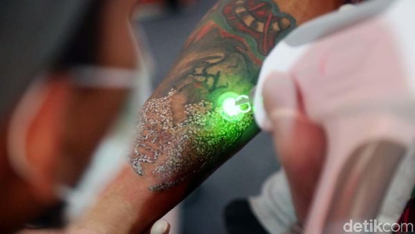 Foto: Ratusan Orang Ikuti Layanan Hapus Tato