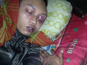 Kesulitan Berobat, Zulfikar TKI di Malaysia akan Dipulangkan